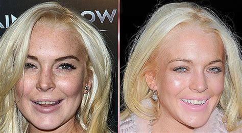 Celebs With The Worst Teeth .